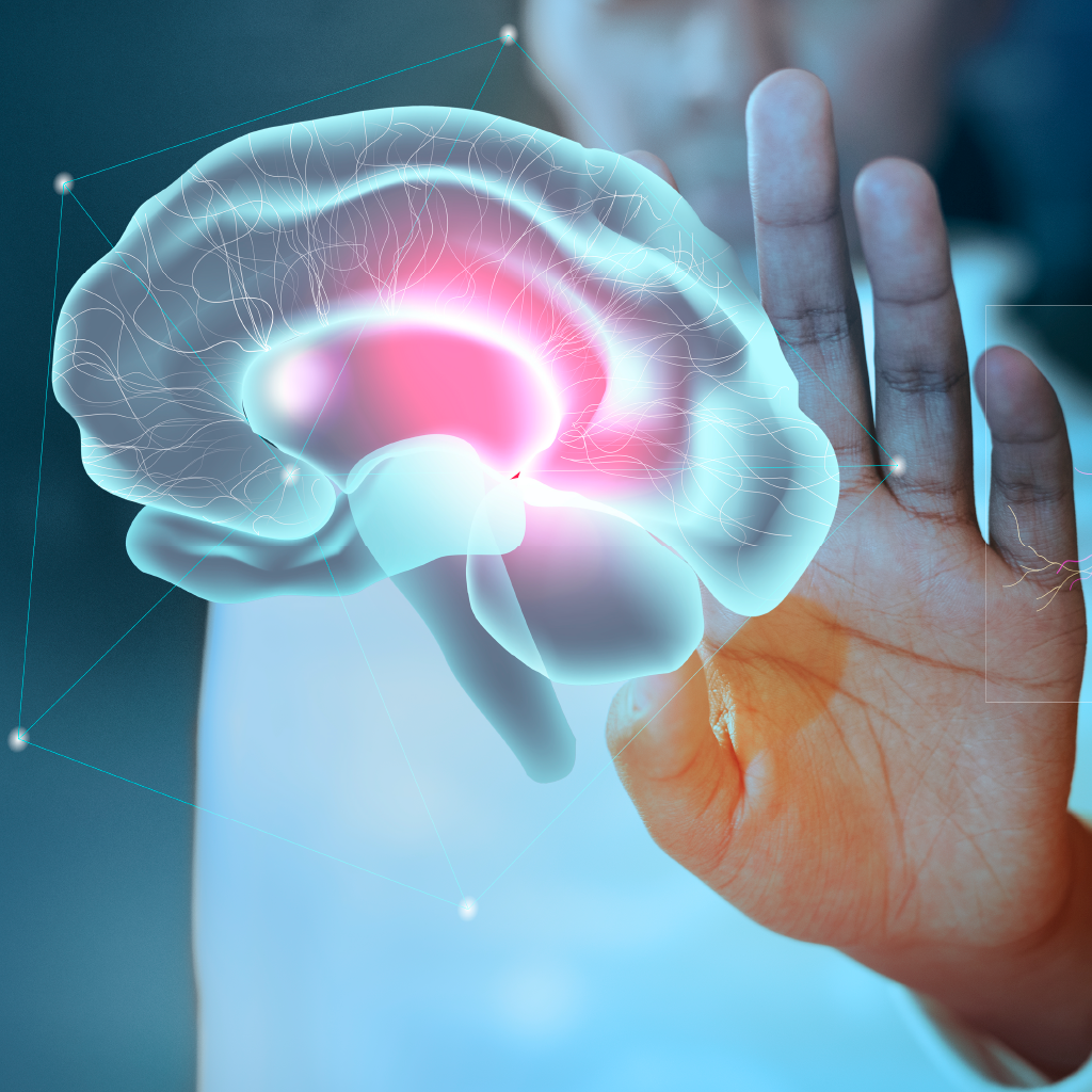 NEUROVENTAS